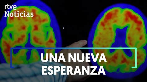 Alzheimer Un F Rmaco Experimental Ralentiza El Deterioro Cognitivo Un