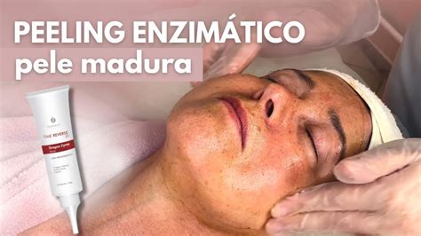 Limpeza De Pele Profissional Peeling Enzim Tico Youtube