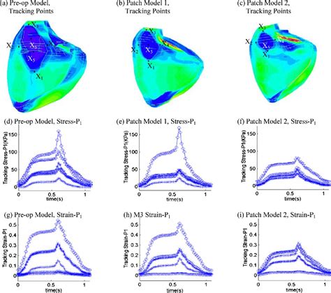 Figure 10 From Patient Specific MRI Based 3D FSI RV LV Patch Models For