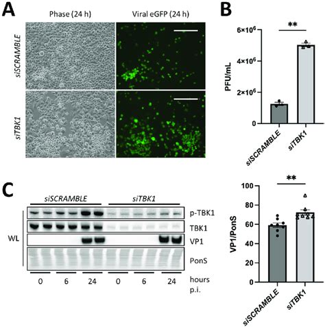 Silencing TBK1 Increases CVB Infection HeLa Cells Were Treated With