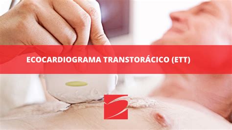 ECOCARDIOGRAMA TRANSTORÁCICO ETT ICOR Instituto do Coração de