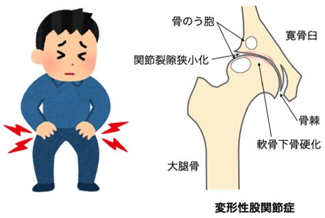 整形外科｜診療科目・各部門｜社会医療法人垣谷会 明治橋病院