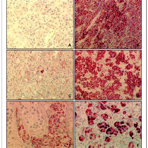 Pde11a Immunohistochemistry Download Scientific Diagram