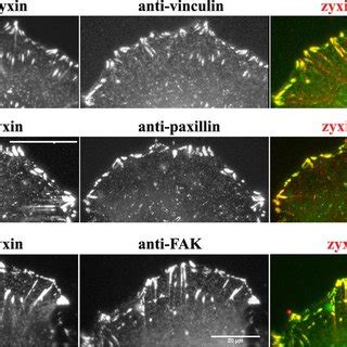 Differential behavior of focal adhesion proteins. The distribution of ...