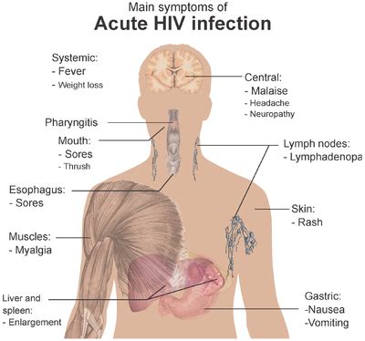 Human Immunodeficiency Virus Hiv Physiopedia