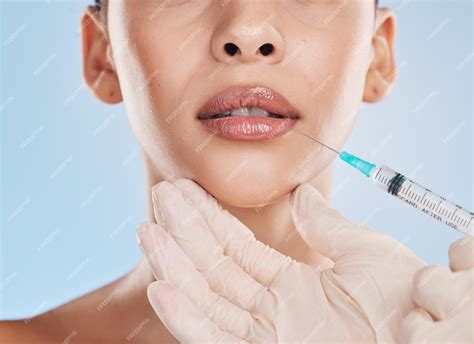 Colágeno De Cirurgia Plástica E Preenchimento Labial Para Beleza Facial