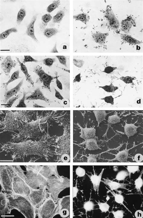 Phase Contrast Micrographs Of HEp 2 Cells Exposed To Bacteria A To D