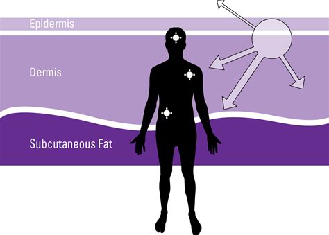 Stages of Melanoma - AIM at Melanoma Foundation