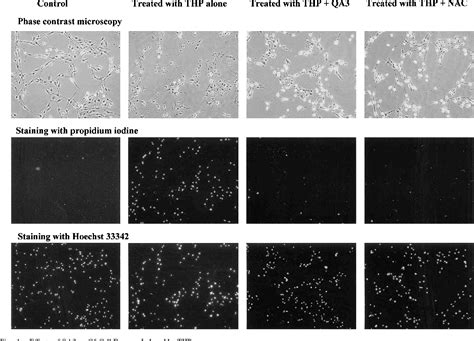 Figure 1 From Protective Effects Of Quinic Acid Derivatives On