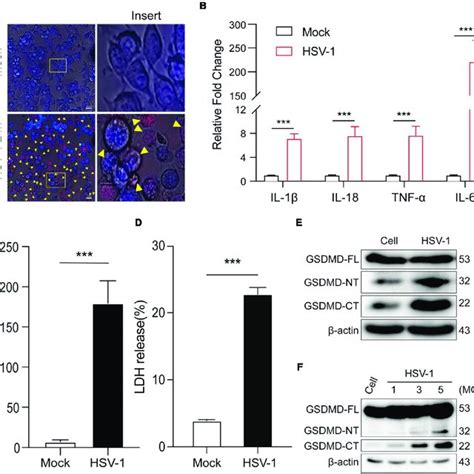 Hsv 1 Infection Induces Pyroptosis And Triggers Interleukin 1β