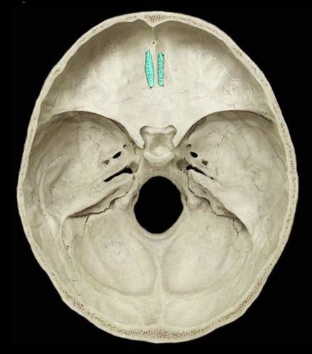 A & P I Lab 10 - Cranial Nerves Foramina Flashcards | Quizlet