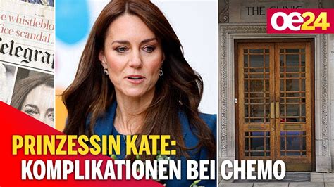 Prinzessin Kate Komplikationen Bei Chemo Therapie YouTube