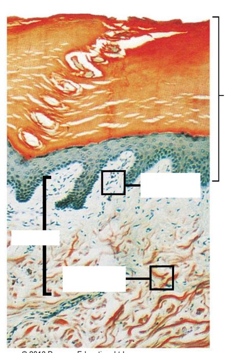 Dermis layers Diagram | Quizlet