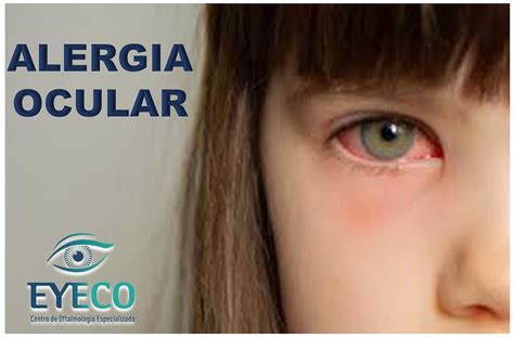 Olhos Vermelhos E Coceira Tudo O Que Voc Precisa Saber Sobre Alergia