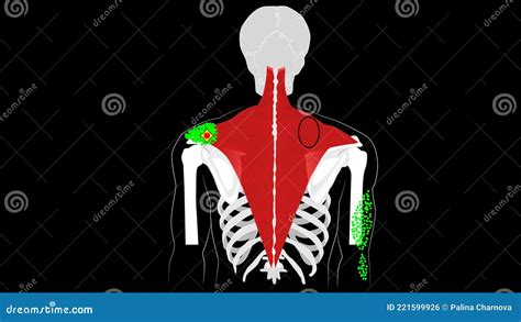 Trigger Points And Reflected Pain In The Trapezius Stock Illustration