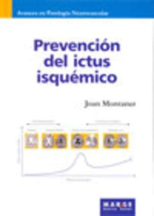 Prevención del ictus isquémico