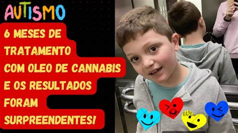 Autismo Leo De Cannabis Mudou A Vida Do Meu Filho Autista E Eu Posso