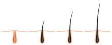 hair follicle  stock photo public domain pictures