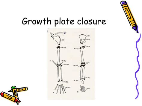 how to know if growth plates have closed