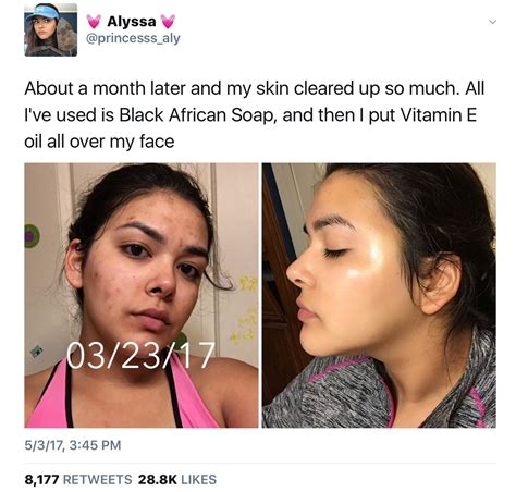 Pinterest Lowkeyy Wifeyy Face Skin Care Makeup Skin Care Skin Tips