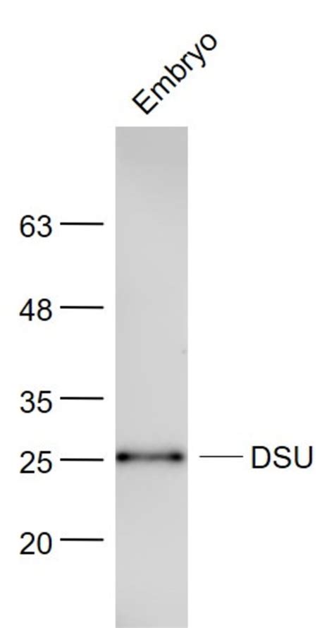 DSU Rabbit anti Human Polyclonal Bioss 100 µL Unconjugated Fisher