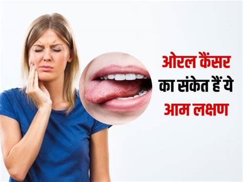 Oral Cancer ओरल कैंसर का संकेत मुंह में दिखने वाले ये 5 लक्षण जिन्हें