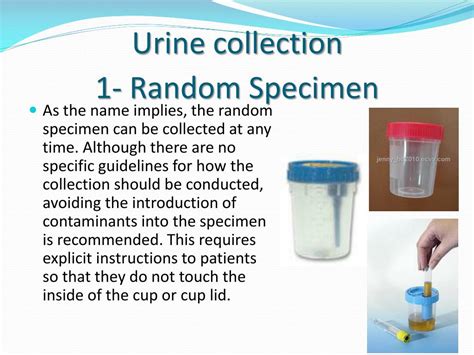 Urine Culture Introduction Importance Sample Collection Test Procedure ...