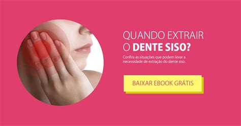 Ebook Quando Extrair O Dente Siso Conquist Odontologia