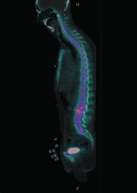 Magnetic Resonance Imaging MRI And Single Photon Emission Computed