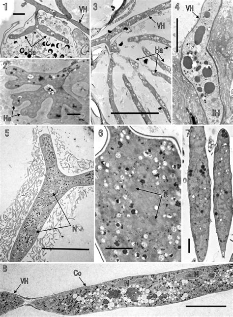 Electron micrographs of haustoria, infection hypha, and conidia in the ...