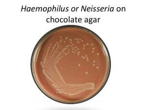 Chocolate Agar media - Preparation and Uses - Laboratoryinfo.com