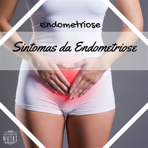 Endometriose Uma Condi O Na Qual O Endom Trio Mucosa Que Reveste A