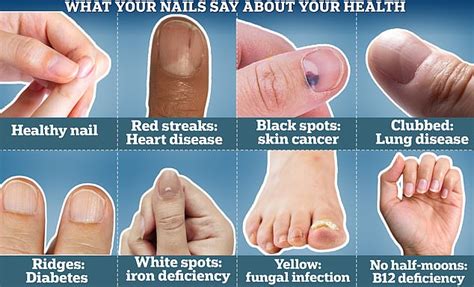 What Your Nails Say About Your Health According To An Expert