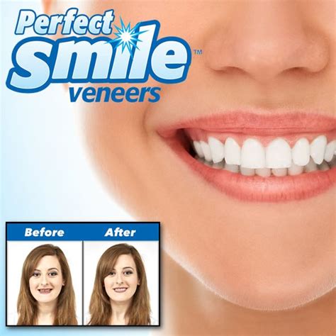 Perfect Smile Veneers As Seen On Tv