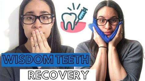 WISDOM TEETH EXTRACTION RECOVERY UNDER LOCAL ANESTHESIA YouTube