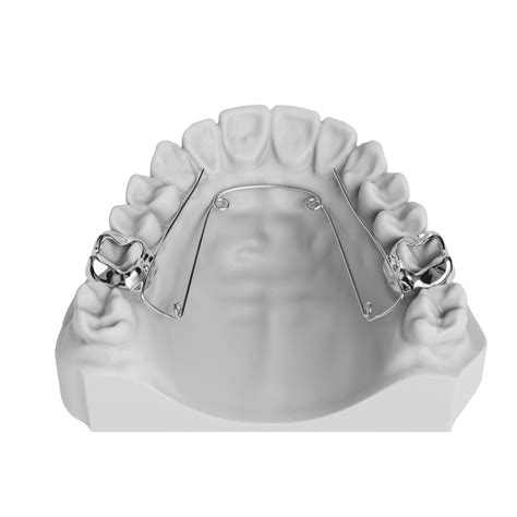 Quad Helix Odl Orthodontic Labs