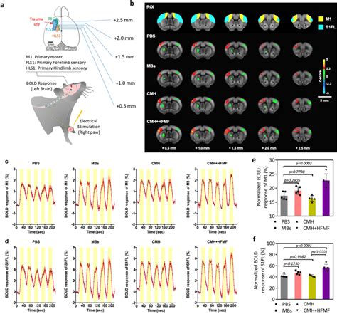 Blood Oxygenation Level Dependent BOLD FMRI Activation Maps During