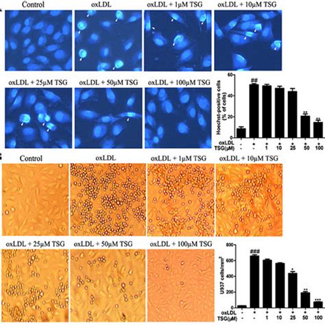 Effects Of Tsg On Oxldl Induced Apoptosis And Monocyte Adhesion In