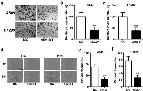 Miat Knockdown Repressed Cell Migration And Invasion In Non Small Cell