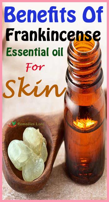 Benefits of Frankincense Essential Oil for Skin - Remedies Lore