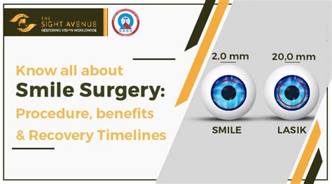 ReLEx Smile Surgery Procedure Benefits And Precautions