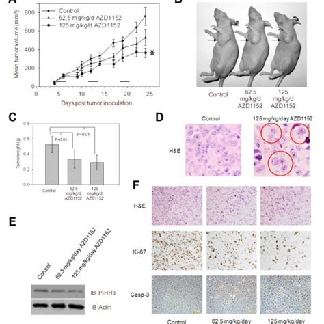 Azd1152 Inhibits Orthotopically Xenografted Her18 Cells In Nude Mice