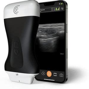 Ecógrafo de mano PA HD3 Clarius Mobile Health para ecografía