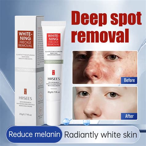 【hiisees】buy 1 Take 1 Effective Melasma Cream Pekas Remover Skin