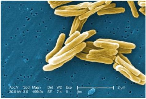 2: Mycobacterium tuberculosis electron micrograph . | Download Scientific Diagram