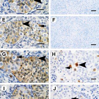 AHR Activation Increases Cleaved PARP Expression In Human Fetal Testis