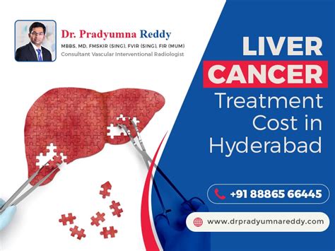 Liver Cancer Treatment