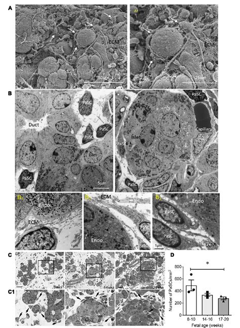 Figure 1 From Activation Of Pancreatic Stellate Cells Is Beneficial For