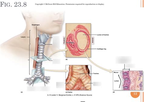 Trachea Diagram | Quizlet