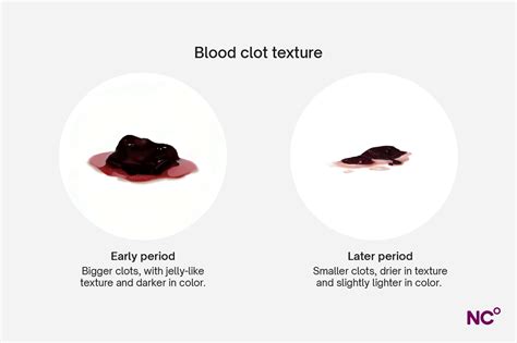 Period Blood Clots (Image): What Are They, Causes, & Are They Normal